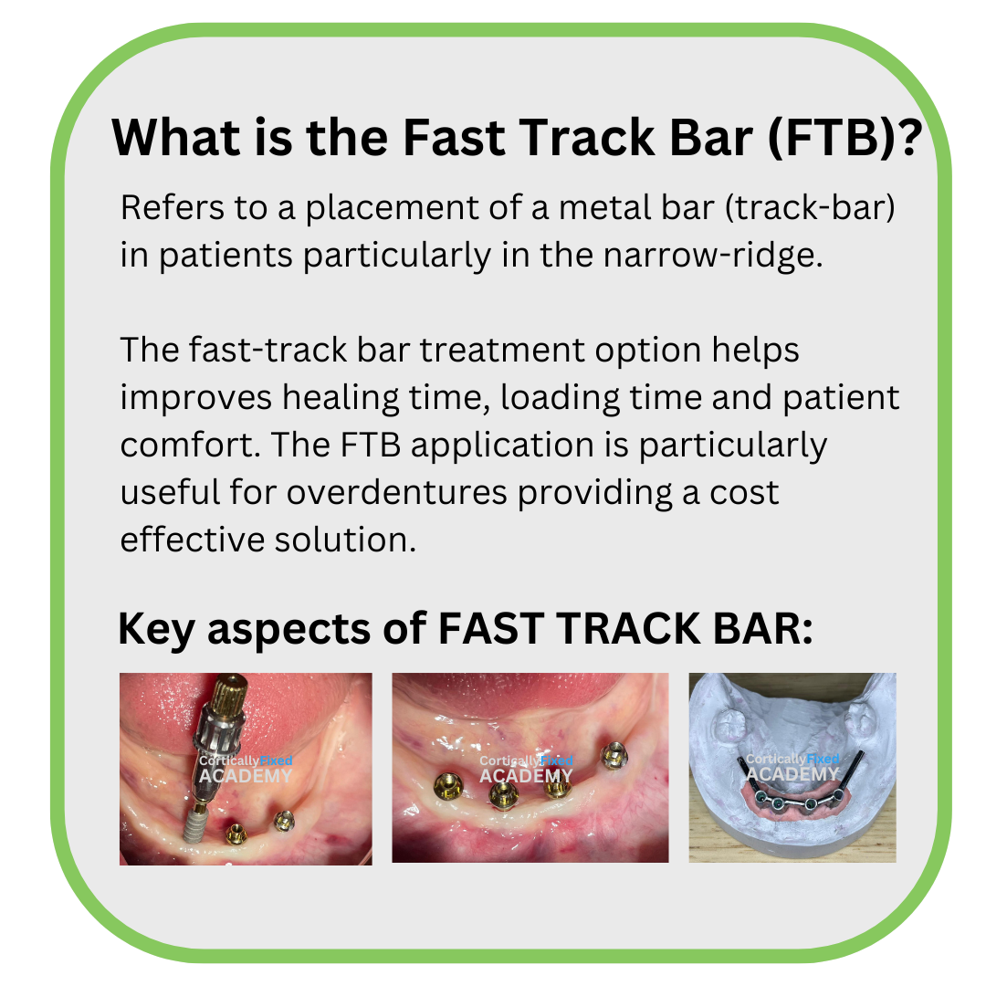 Fast Track Bar